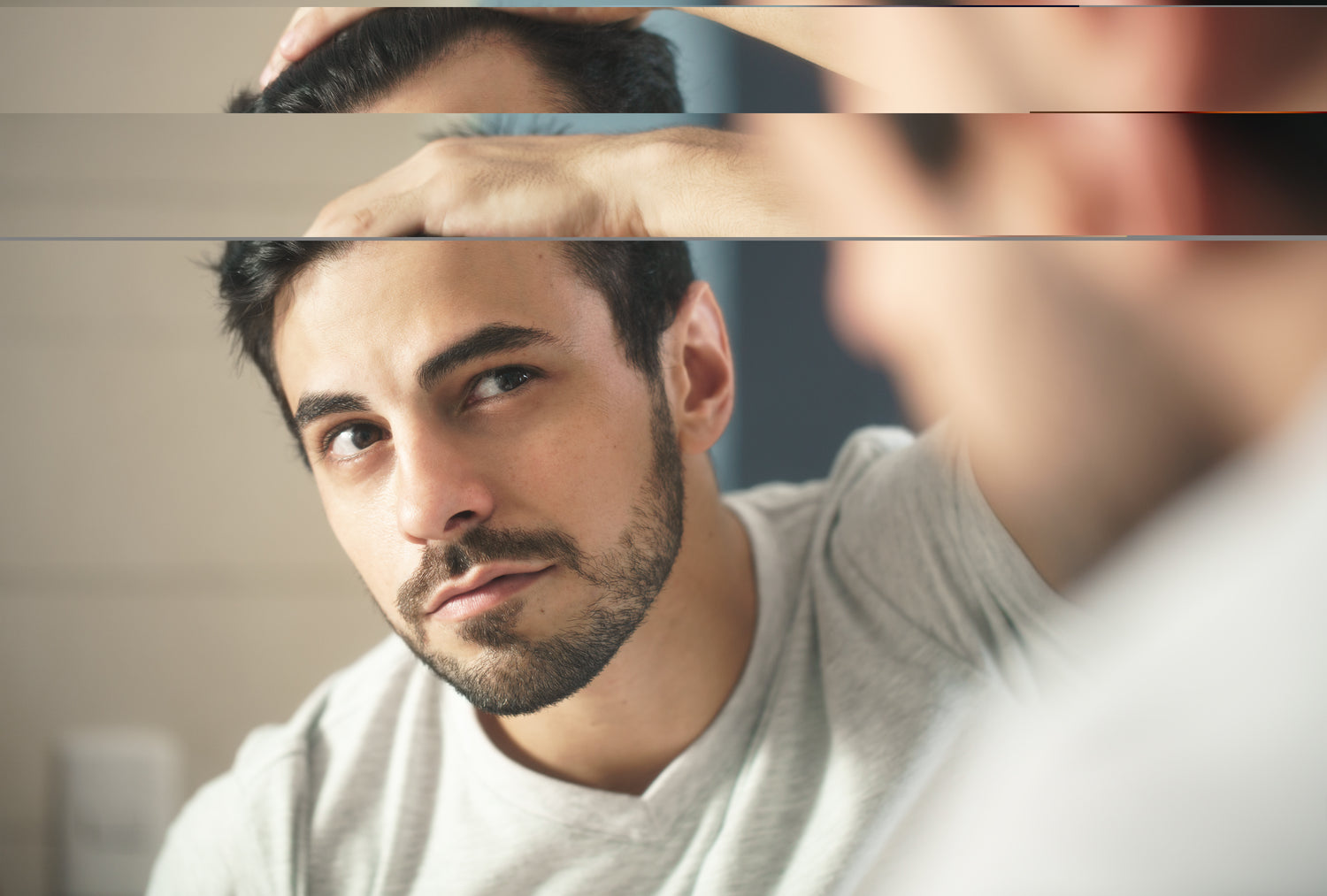 Men hair loss